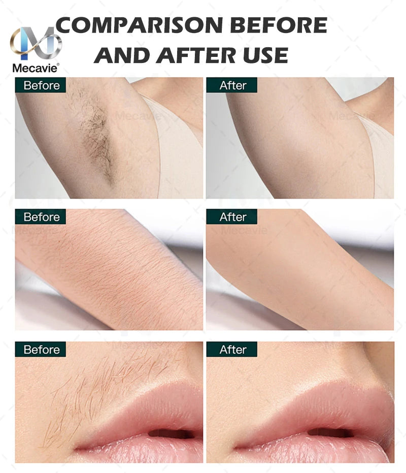 Mini Professional Diode Laser Hair Removal Device 4000w High Power 755nm 808nm 940nm 1064nm Painless Permanent Magic Electronics S456a252d78504007aef7a47478abeae3m