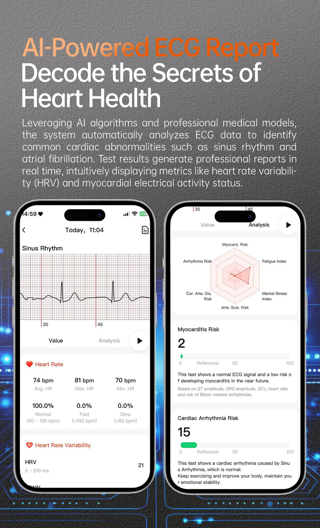 New upgrade High end Analysis Health Smart Watch Sapphire screen ECG Uric Acid BP Blood Oxygen Body Fat HD Call NFC Smart Watch Magic Electronics S6bcf0975c12944e0ad4e954a20a7f325A