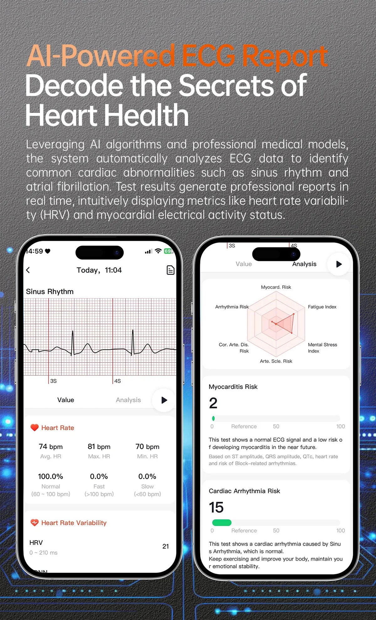 New upgrade High end Analysis Health Smart Watch Sapphire screen ECG Uric Acid BP Blood Oxygen Body Fat HD Call NFC Smart Watch Magic Electronics S6bcf0975c12944e0ad4e954a20a7f325A