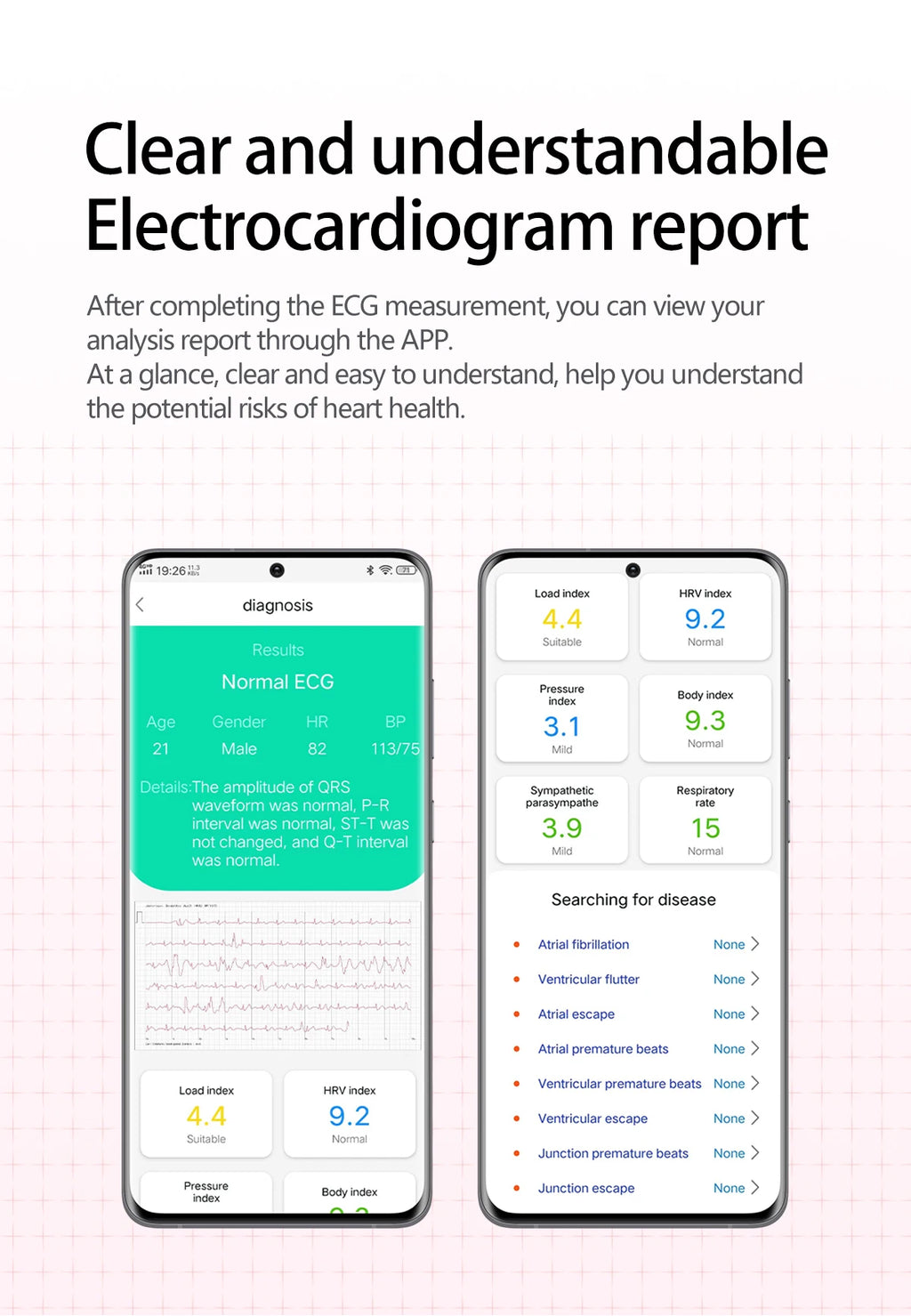 2026 New Upgrade AI Diagnostic Airbag Precise Blood Pressure Health SmartWatch Uric Acid ECG Blood lipids Smartwatch Men Women Magic Electronics S9a3269fc3cc74909a71a7dcc2dac4c82P