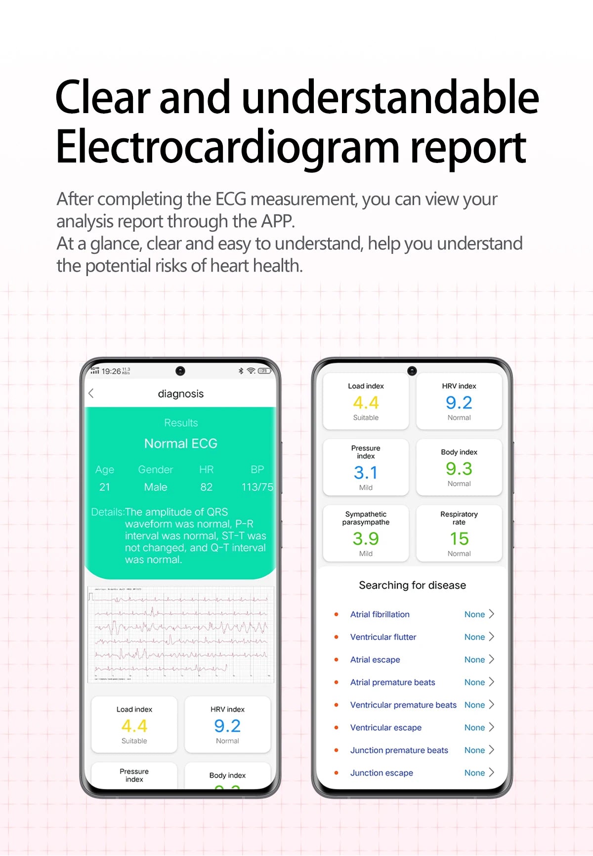 2026 New Upgrade AI Diagnostic Airbag Precise Blood Pressure Health SmartWatch Uric Acid ECG Blood lipids Smartwatch Men Women Magic Electronics S9a3269fc3cc74909a71a7dcc2dac4c82P