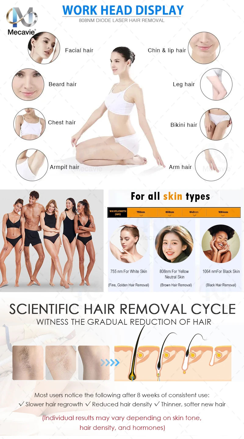Mini Professional Diode Laser Hair Removal Device 4000w High Power 755nm 808nm 940nm 1064nm Painless Permanent Magic Electronics Sd730e78a50004a7bbb967a945ea5a3fbU